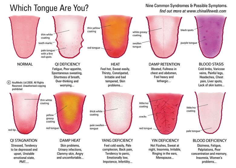 Tongue Diagnosis and Tips for Healthy Living